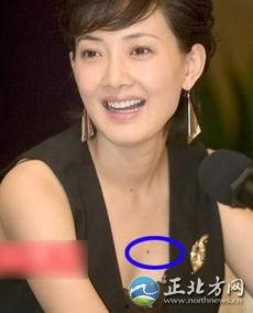 眉头有痣明星,那些眉痣熠熠生辉的明星风采